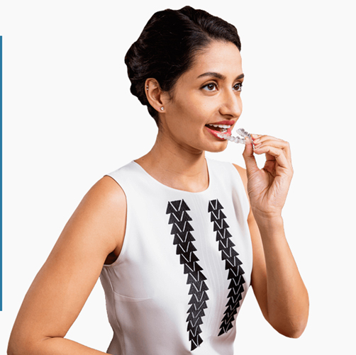  Who are Spark aligners for?