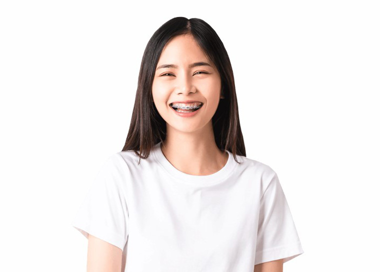  Transform your smile with traditional braces