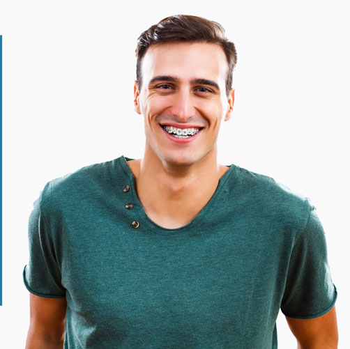 Who are conventional braces for? Who are conventional braces for?